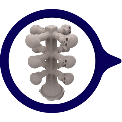 Casting Raw Materials | Valve-tek, Investment Casting